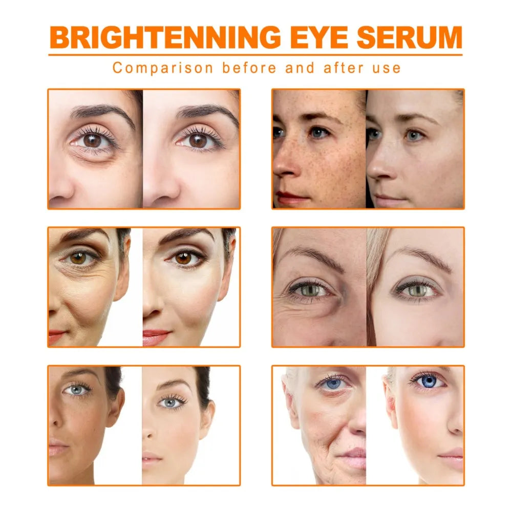 Turmeric Anti Aging Oil Remove Dark Spots